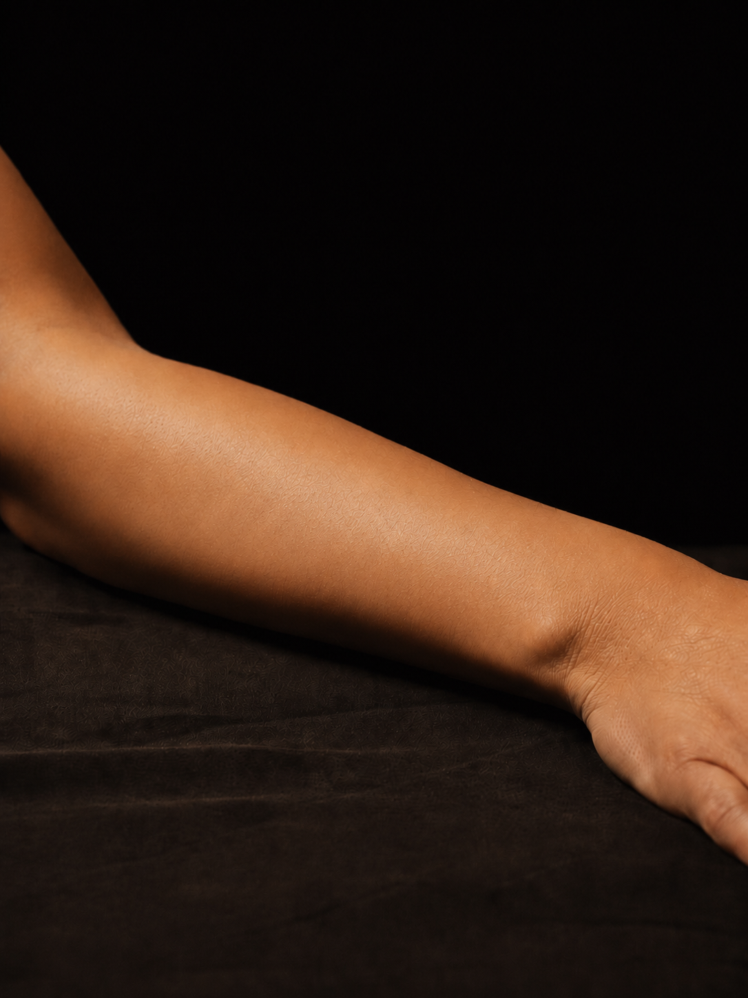 After laser hair removal