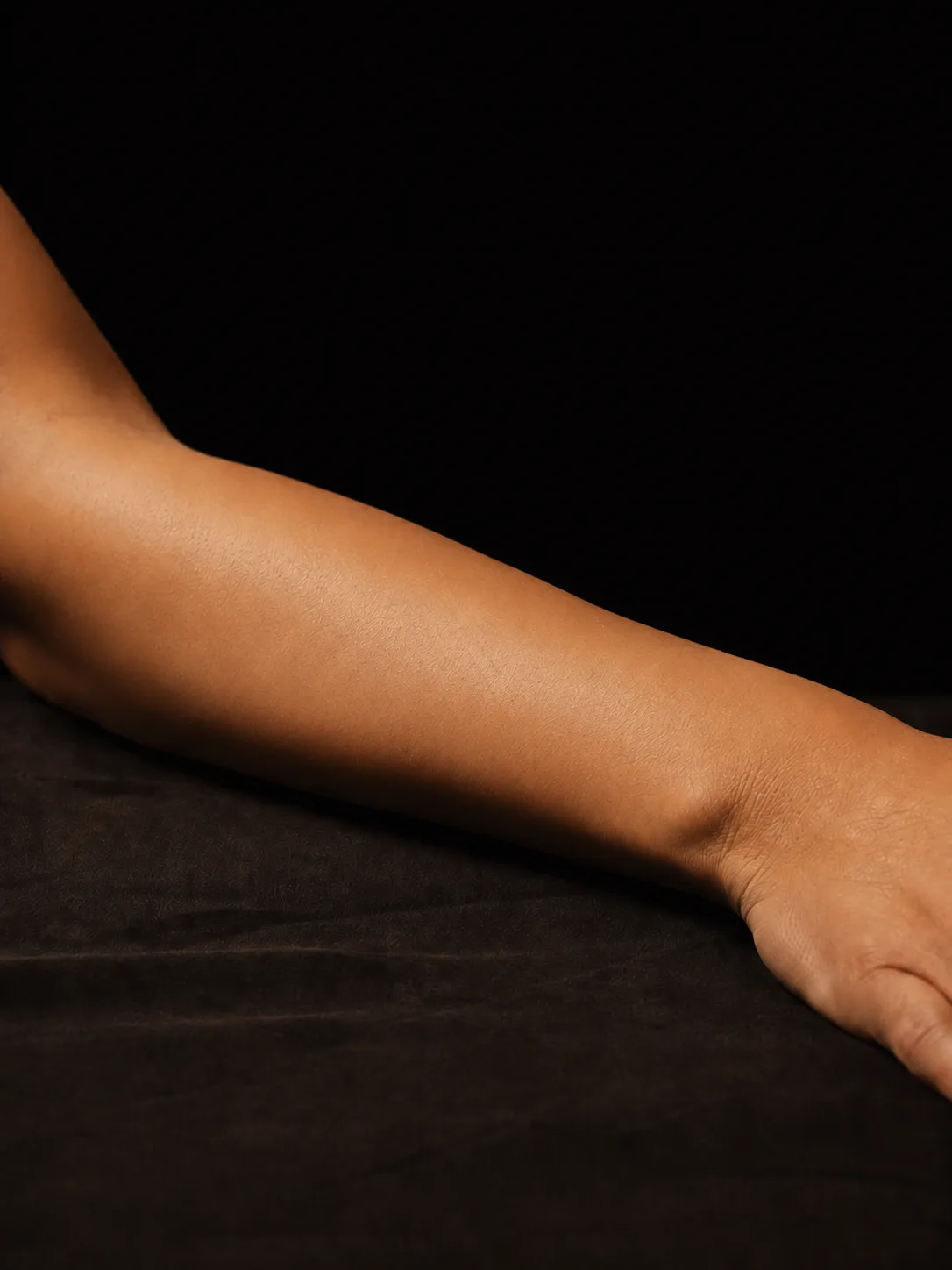 Full Arms after laser hair removal