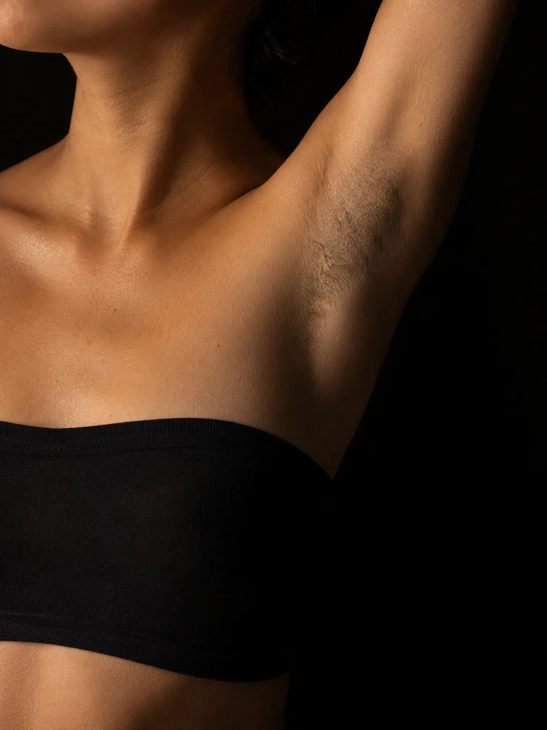 Underarms before laser hair removal